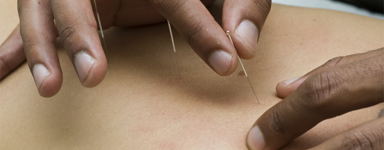 https://reboundphysicaltherapy.com/wp-content/uploads/2018/11/dry-needling-912-1280x500-1.jpg